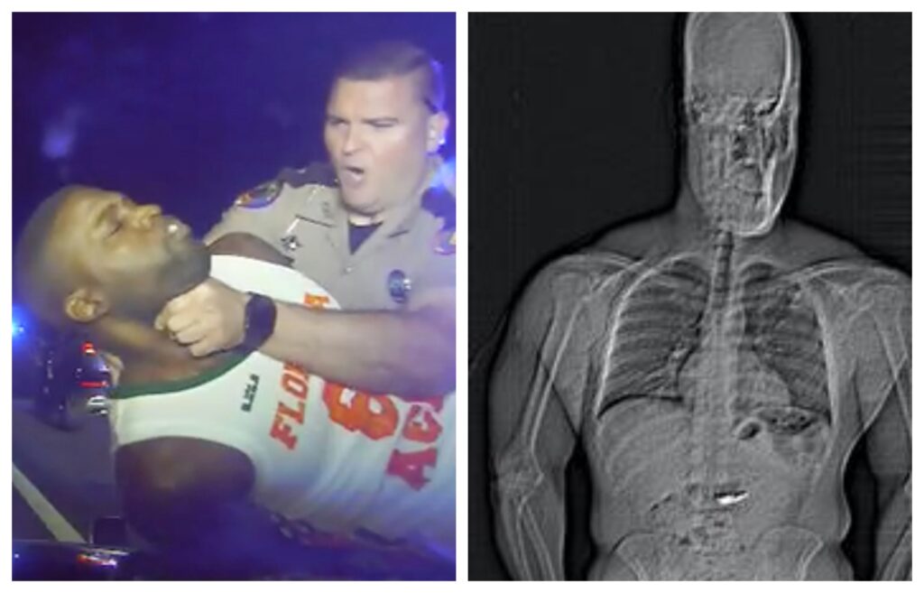 Why This Florida Man Swallowed Nearly $800,000 in Jewelry and What Happened Next